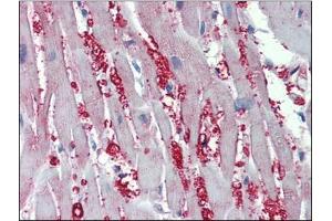 Human Heart: Formalin-Fixed, Paraffin-Embedded (FFPE) (alpha 1 Adrenergic Receptor antibody  (AA 206-270))