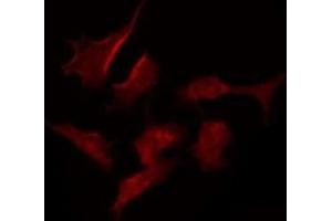 ABIN6275389 staining MCF7 by IF/ICC. (KCNV2 antibody  (N-Term))