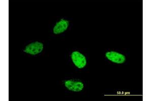 Immunofluorescence of monoclonal antibody to AOF2 on HeLa cell. (LSD1 antibody  (AA 753-851))