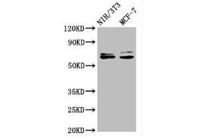 Western Blot Positive WB detected in: NIH/3T3 whole cell lysate, MCF-7 whole cell lysate All lanes: SRC antibody at 1. (Recombinant Src antibody)