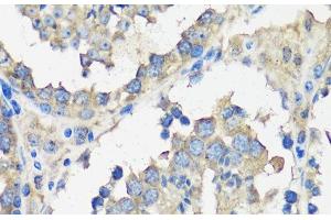 Immunohistochemistry of paraffin-embedded Mouse testis using ASZ1 Polyclonal Antibody at dilution of 1:100 (40x lens). (ASZ1 antibody)