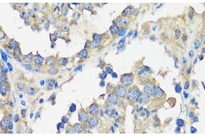 Immunohistochemistry of paraffin-embedded Mouse testis using ASZ1 Polyclonal Antibody at dilution of 1:100 (40x lens).
