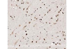ABIN6266649 at 1/100 staining human brain tissue sections by IHC-P. (UBR5 antibody  (N-Term))