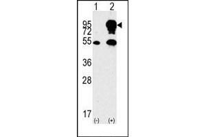 Image no. 1 for anti-B-Raf proto-oncogene, serine/threonine kinase (BRAF) (Middle Region) antibody (ABIN360129) (BRAF antibody  (Middle Region))
