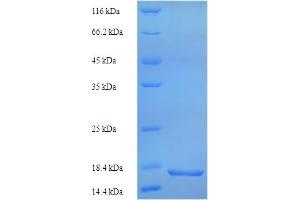SDS-PAGE (SDS) image for phospholipase A2 Receptor 1, 180kDa (PLA2R1) (AA 395-530) protein (His tag) (ABIN4976552)