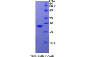 SDS-PAGE analysis of Cow PPARG Protein.