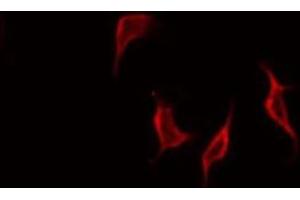 ABIN6268776 staining HepG2 by IF/ICC. (MMP 9 antibody  (C-Term))