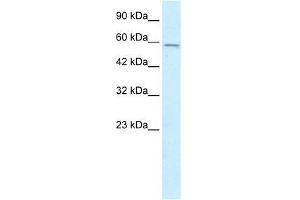 Human HepG2; WB Suggested Anti-MGC4618 Antibody Titration: 0. (TMEM175 antibody  (N-Term))