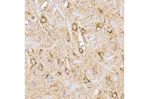 Immunohistochemistry of paraffin-embedded rat brain using NDUFB9 Rabbit mAb (ABIN7268815) at dilution of 1:200 (40x lens). (NDUFB9 antibody)