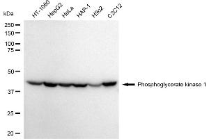 Western blotting analysis using Phosphoglycerate kinase 1 antibody (ABIN7799809). (PGK1 antibody)