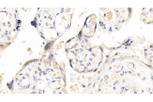 Detection of ADAM12 in Human Placenta Tissue using Polyclonal Antibody to A Disintegrin And Metalloprotease 12 (ADAM12) (ADAM12 antibody  (AA 513-767))