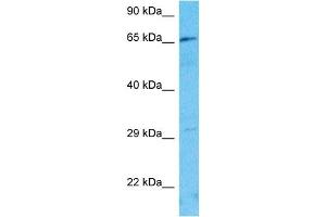 Host:  Rabbit  Target Name:  FBXL19  Sample Type:  Jurkat Whole Cell lysates  Antibody Dilution:  1. (FBXL19 antibody  (Middle Region))