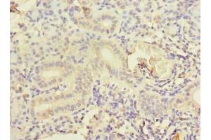 Immunohistochemistry of paraffin-embedded human pancreatic tissue using ABIN7148943 at dilution of 1:100 (CCNJL antibody  (AA 315-435))