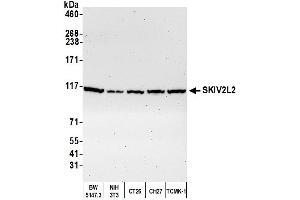 Western Blotting (WB) image for anti-Superkiller Viralicidic Activity 2-Like 2 (SKIV2L2) (AA 100-150) antibody (ABIN7449416)