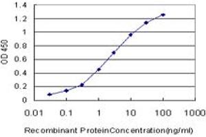 Detection limit for recombinant GST tagged MKI67 is approximately 0. (Ki-67 antibody  (AA 3157-3256))