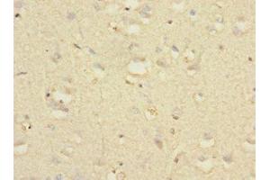 Immunohistochemistry of paraffin-embedded human brain tissue using ABIN7161462 at dilution of 1:100 (Neurotrimin antibody  (AA 30-316))