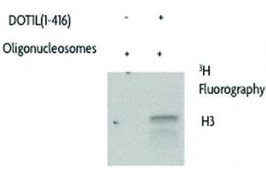 DOT1L (1-416), active activity assay using Recombinant Nucleosomes as substrates. (DOT1L Protein (AA 1-416) (GST tag))