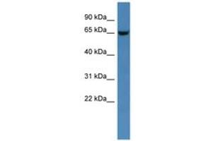 Image no. 1 for anti-Glucosamine (N-Acetyl)-6-Sulfatase (GNS) (AA 312-361) antibody (ABIN6746256) (GNS antibody  (AA 312-361))