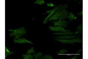 Immunofluorescence of monoclonal antibody to DPH2 on HeLa cell. (DPH2 antibody  (AA 1-489))