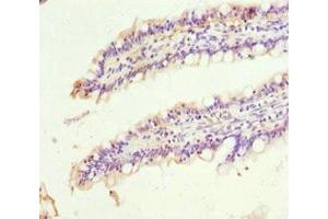 Immunohistochemistry of paraffin-embedded human small intestine tissue using ABIN7169557 at dilution of 1:100 (SIGLEC12 antibody  (AA 20-210))