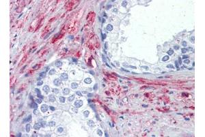 IHC Image for AP22885PU-N Prostate, Human: Formalin-Fixed, Paraffin-Embedded (FFPE) (PRKG1 antibody)