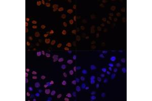 Immunofluorescence (IF) image for anti-Histone H2B (acLys12) antibody (ABIN7267731)