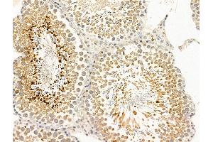 ABIN7094857 and ABIN7098908 at 1/100 staining Rat testis tissue by IHC-P. (CCDC34 antibody  (C-Term))
