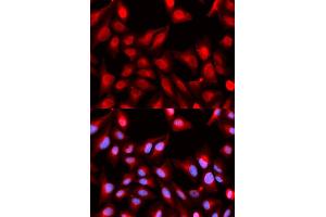 Immunofluorescence analysis of U2OS cells using DDX5 antibody (ABIN5973042). (DDX5 antibody)