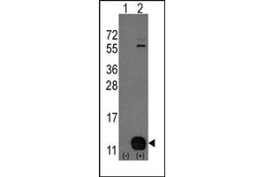 Image no. 1 for anti-phosphohistidine Phosphatase 1 (PHPT1) (N-Term) antibody (ABIN357857) (PHPT1 antibody  (N-Term))