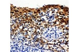 IHC-P: 14-3-3 sigma antibody testing of human tonsil tissue (14-3-3 sigma/SFN antibody  (AA 140-156))