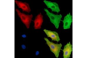 anti-FERM Domain Containing 4A (FRMD4A) antibody