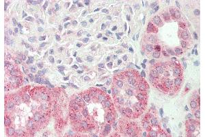 Rabbit Anti-KLHL25 antibody  Formalin Fixed Paraffin Embedded Tissue: Human Kidney Primary antibody Concentration: 1:100 Secondary Antibody: Donkey anti-Rabbit-Cy3 Secondary Antibody Concentration: 1:200 Magnification: 20x Exposure Time: 0. (KLHL25 antibody  (N-Term))
