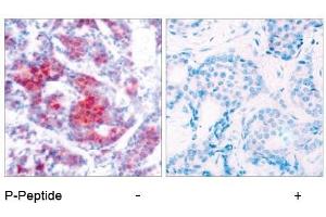Image no. 1 for anti-Signal Transducer and Activator of Transcription 4 (STAT4) (pTyr693) antibody (ABIN196694) (STAT4 antibody  (pTyr693))