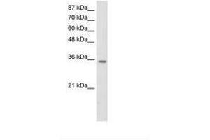 Image no. 1 for anti-Homeobox D4 (HOXD4) (C-Term) antibody (ABIN202128) (HOXD4 antibody  (C-Term))