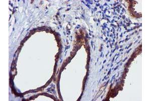 Immunohistochemical staining of paraffin-embedded Human breast tissue using anti-EPN2 mouse monoclonal antibody.