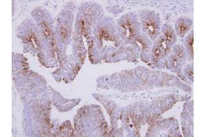 Image no. 1 for anti-Microtubule-Associated Protein 7 (MAP7) (C-Term) antibody (ABIN1491813) (MAP7 antibody  (C-Term))