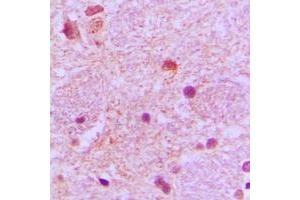 Immunohistochemical analysis of TP53INP1 staining in human brain formalin fixed paraffin embedded tissue section. (TP53INP1 antibody  (C-Term))