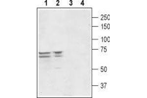 Western blot analysis of rat (lanes 1 and 3) and mouse (lanes 2 and 4) brain lysates: - 1,2. (Peroxisomal Biogenesis Factor 5-Like (PEX5L) (AA 151-165), (Intracellular) antibody)