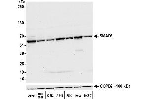 Western Blotting (WB) image for anti-SMAD, Mothers Against DPP Homolog 2 (SMAD2) (AA 225-275) antibody (ABIN7454016) (Recombinant SMAD2 antibody  (AA 225-275))