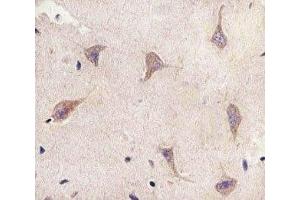 IHC analysis of FFPE human brain section using TSC2 antibody; Ab was diluted at 1:25. (Tuberin antibody  (AA 1397-1426))