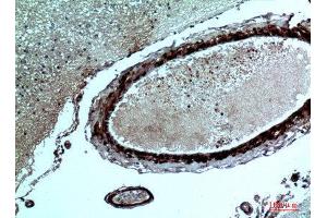 Immunohistochemistry (IHC) analysis of paraffin-embedded Human Brain, antibody was diluted at 1:100. (FGF17 antibody  (Internal Region))