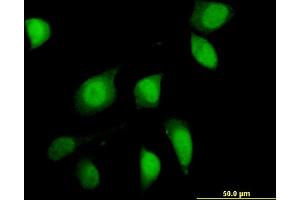 Immunofluorescence of monoclonal antibody to FOXO1 on HeLa cell. (FOXO1 antibody  (AA 452-555))