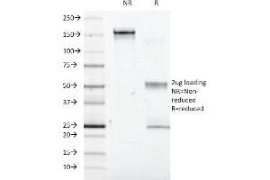 SDS-PAGE Analysis Purified Interferon alpha-1 Mouse Monoclonal Antibody (2-48). (IFNA1 antibody)