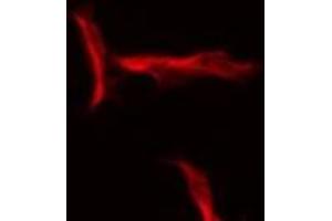 SERPINB12 antibody  (N-Term)