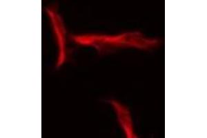 ABIN6275554 staining HeLa by IF/ICC. (SERPINB12 antibody  (N-Term))