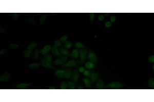 Immunofluorescence analysis of MCF-7 cells using CTSE Polyclonal Antibody (Cathepsin E antibody)