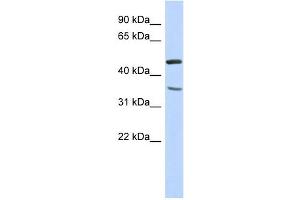 FAM81B antibody used at 1 ug/ml to detect target protein. (FAM81B antibody  (N-Term))