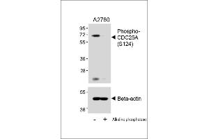 Western blot analysis of lysates from  cell line, untreated or treated with Alkaline phosphatase, 1h, using 459088101 A (upper) or Beta-actin (lower). (CDC25A antibody  (pSer124))