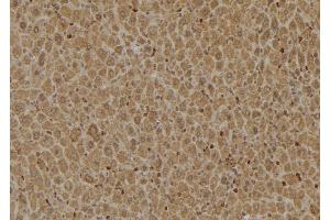 ABIN6274922 at 1/100 staining Mouse liver tissue by IHC-P. (FAM203B antibody  (Internal Region))