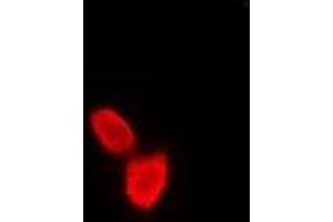 Immunofluorescent analysis of SATB1 staining in A549 cells. (SATB1 antibody)
